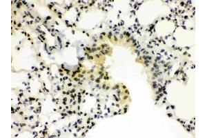 IHC analysis of SP3 using anti-SP3 antibody (ABIN3043350).