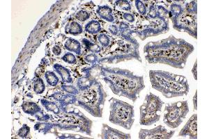 Immunohistochemistry (IHC) image for anti-Cytoglobin (CYGB) (AA 1-190) antibody (ABIN5518753)