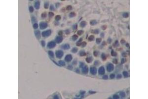 Used in DAB staining on fromalin fixed paraffin- embedded Kidney tissue (Nanog Antikörper  (AA 1-305))