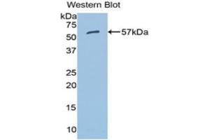 Western Blotting (WB) image for anti-Aldehyde Dehydrogenase 7 Family, Member A1 (ALDH7A1) (AA 28-539) antibody (ABIN1077761) (ALDH7A1 Antikörper  (AA 28-539))