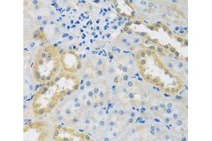Immunohistochemistry of paraffin-embedded Rat kidney using PMPCB Polyclonal Antibody at dilution of 1:100 (40x lens). (PMPCB Antikörper)