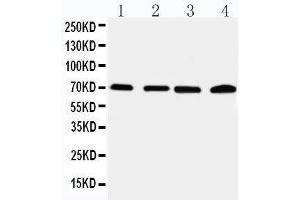Anti-IRAK2 antibody, Western blotting Lane 1: 22RV Cell Lysate Lane 2: A549 Cell Lysate Lane 3: PANC Cell Lysate Lane 4: SMMC Cell Lysate