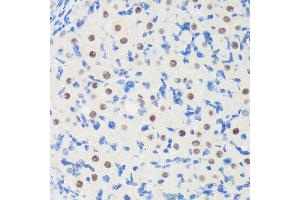 Immunohistochemistry (IHC) image for anti-La Ribonucleoprotein Domain Family, Member 1B (LARP1B) (AA 170-320) antibody (ABIN6143090)