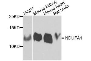 Western blot analysis of extracts of various cell lines, using NDUFA1 antibody. (NDUFA1 Antikörper  (AA 1-70))