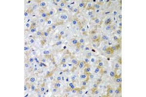 Immunohistochemistry of paraffin-embedded human liver injury using SRGN antibody at dilution of 1:200 (40x lens). (SRGN Antikörper)