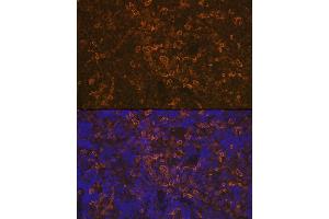Immunofluorescence analysis of rat spleen using LSP1 Rabbit mAb (ABIN7268319) at dilution of 1:100 (40x lens). (LSP1 Antikörper)