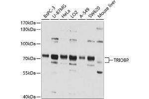 TRIOBP Antikörper  (AA 180-310)