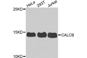 Western blot analysis of extracts of various cell lines, using CALCB antibody (ABIN5974487) at 1/1000 dilution. (CALCB Antikörper)