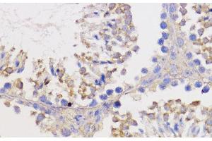 Immunohistochemistry of paraffin-embedded Mouse testis using Bcl-2 Polyclonal Antibody at dilution of 1:100 (40x lens). (Bcl-2 Antikörper)