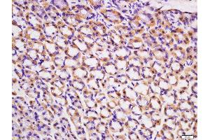 Immunohistochemistry (Paraffin-embedded Sections) (IHC (p)) image for anti-Activin A Receptor, Type IIB (ACVR2B) (AA 45-150) antibody (ABIN1714650)