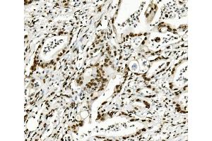 IHC analysis of KAP1/TRIM28 using anti-KAP1/TRIM28 antibody (ABIN7602310).