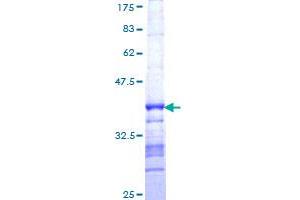 DPYSL3 Protein (AA 457-555) (GST tag)