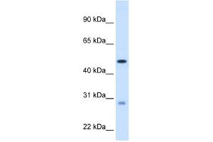 WB Suggested Anti-ECHS1 Antibody Titration:  1. (ECHS1 Antikörper  (C-Term))