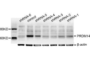 Dot Blot (DB) image for anti-PR Domain Containing 14 (PRDM14) antibody (ABIN1876766) (PRDM14 Antikörper)
