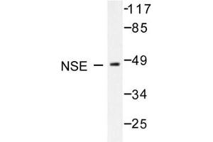 Image no. 1 for anti-Enolase 2 (Gamma, Neuronal) (ENO2) antibody (ABIN271752) (ENO2/NSE Antikörper)