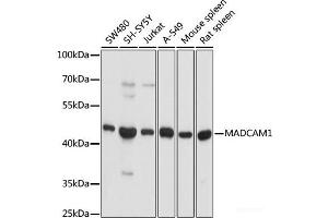 Western blot analysis of extracts of various cell lines using MADCAM1 Polyclonal Antibody at dilution of 1:1000. (MADCAM1 Antikörper)