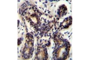 Immunohistochemistry analysis in formalin fixed and paraffin embedded human breast tissue reacted with AP52820PU-N, which was peroxidase conjugated to the secondary antibody and followed by DAB staining. (NBPF8 Antikörper  (N-Term))