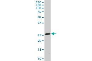 Western Blotting (WB) image for anti-Defective in Cullin Neddylation 1, Domain Containing 1 (DCUN1D1) (AA 1-89) antibody (ABIN565719)
