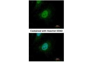 ICC/IF Image Immunofluorescence analysis of paraformaldehyde-fixed HeLa, using SMAD9, antibody at 1:500 dilution. (SMAD9 Antikörper)