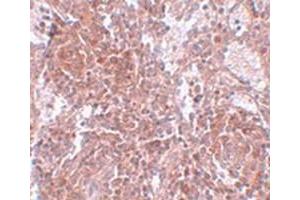 Immunohistochemical staining of human spleen tissue with TSPAN9 polyclonal antibody  at 25 ug/mL dilution.
