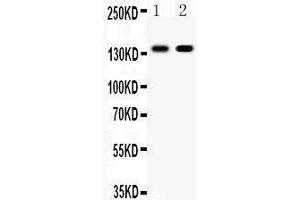 Observed bind size: 140KD (E-cadherin Antikörper  (AA 286-703))