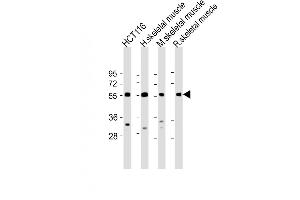 Western Blot at 1:2000 dilution Lane 1: HCT116 whole cell lysate Lane 2: human skeletal muscle lysate Lane 3: mouse skeletal muscle lysate Lane 4: rat skeletal muscle lysate Lysates/proteins at 20 ug per lane. (TRIM72 Antikörper  (C-Term))