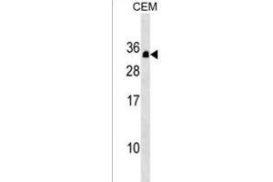 PDCD10 Antibody (Center) (ABIN1538712 and ABIN2849495) western blot analysis in CEM cell line lysates (35 μg/lane).