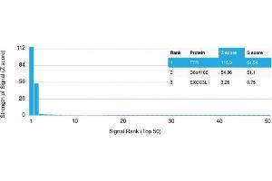 Analysis of Protein Array containing more than 19,000 full-length human proteins using Transthyretin (Prealbumin) Mouse Monoclonal Antibody (CPTC-TTR-1). (TTR Antikörper)