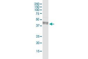 ART3 (Human) IP-WB Antibody Pair