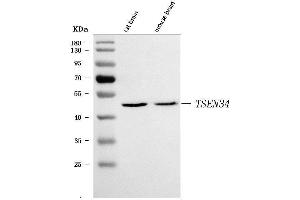 Western blot analysis of TSEN34 using anti-TSEN34 antibody (ABIN7599254).