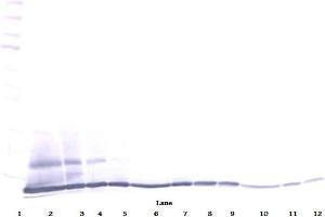 Western Blot (Reduced) using ESkine / CCL27 antibody (CCL27 Antikörper)