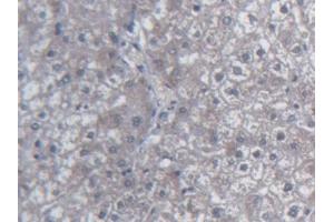 DAB staining on IHC-P; Samples: Human Liver Tissue (Urocortin 2 Antikörper  (AA 20-112))