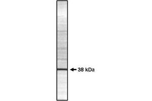 Image no. 1 for anti-Protein Phosphatase 1, Catalytic Subunit, gamma Isoform (PPP1CC) (Isoform gamma 2) antibody (ABIN264937) (PPP1CC Antikörper  (Isoform gamma 2))