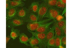 IF analysis of SGTA and Tubulin alpha using anti-SGTA antibody (ABIN7599212) and anti-Tubulin alpha antibody (ABIN7600339).