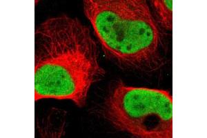 Immunofluorescent staining of U-2 OS with MCM6 polyclonal antibody  (Green) shows positivity in nucleus but excluded from the nucleoli. (MCM6 Antikörper)