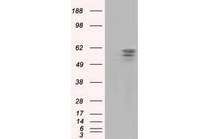 Image no. 2 for anti-Pantothenate Kinase 2 (PANK2) antibody (ABIN1500026) (PANK2 Antikörper)