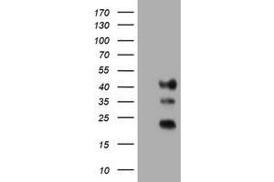 Image no. 1 for anti-Transmembrane Protein 173 (TMEM173) antibody (ABIN1501425) (STING/TMEM173 Antikörper)