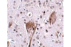 Immunohistochemistry (IHC) image for anti-Spastic Paraplegia 11 (Autosomal Recessive) (SPG11) antibody (ABIN1031796)