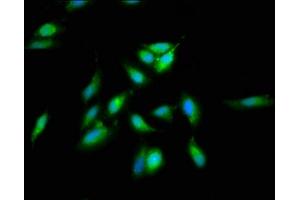 Immunofluorescence staining of Hela cells with ABIN7170782 at 1:66, counter-stained with DAPI. (SREBF2 Antikörper  (AA 75-164))