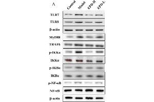 EPD suppressed the activation of the Toll-like receptor 7-myeloid differentiation primary response gene 88-nuclear factor-κB (TLR7/8-MyD88-NF-κB) signaling pathways. (NFKBIA Antikörper  (AA 1-120))