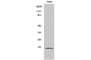 Western Blotting (WB) image for anti-Superoxide Dismutase 1, Soluble (SOD1) antibody (ABIN5958576) (SOD1 Antikörper)