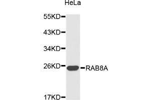 Western blot analysis of extracts of HeLa cells, using RAB8A antibody. (RAB8A Antikörper)