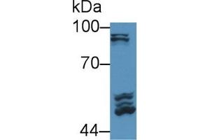 Detection of POSTN in Rat Serum using Polyclonal Antibody to Periostin (POSTN) (Periostin Antikörper  (AA 24-173))