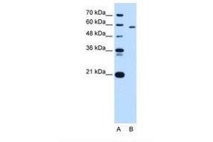Image no. 2 for anti-Pyruvate Kinase, Liver and RBC (PKLR) (AA 56-105) antibody (ABIN320669) (PKLR Antikörper  (AA 56-105))