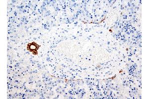 Immunohistochemistry (IHC) image for anti-Keratin 7/17/19 (KRT7/17/19) antibody (ABIN108432) (Keratin 7/17/19 Antikörper)