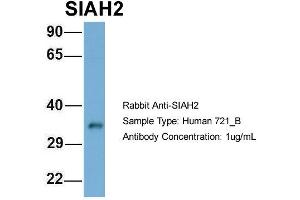Host: Rabbit Target Name: SIAH2 Sample Type: 721_B Antibody Dilution: 1. (SIAH2 Antikörper  (Middle Region))