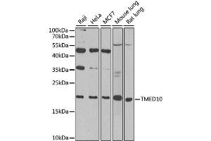 Western blot analysis of extracts of various cell lines, using TMED10 antibody.