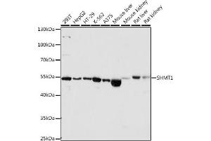 Western blot analysis of extracts of Mouse liver, using SHMT1 antibody (ABIN6132654, ABIN6147744, ABIN6147746 and ABIN6216135) at 1:1560 dilution. (SHMT1 Antikörper  (AA 285-444))