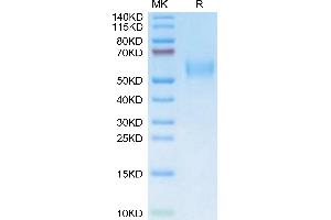 Mouse uPAR isoform 1 on Tris-Bis PAGE under reduced condition. (PLAUR Protein (AA 24-298) (His-Avi Tag))