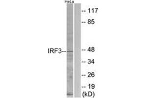 Western blot analysis of extracts from HeLa cells, using IRF3 (Ab-396) Antibody.